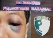 Matemija! Kasus Penganiayaan MAB di Atensi, Penyidik Disoroti
