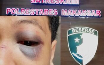 Matemija! Kasus Penganiayaan MAB di Atensi, Penyidik Disoroti