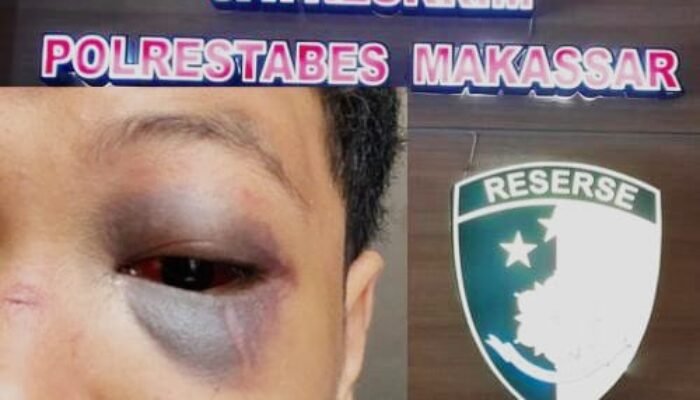 Matemija! Kasus Penganiayaan MAB di Atensi, Penyidik Disoroti