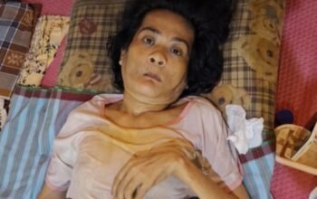 Kodong, Seorang Warga Sinjai Lumpuh 4 Tahun dan Tak Mampu Bayar BPJS