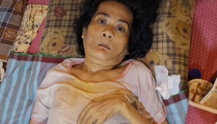 Kodong, Seorang Warga Sinjai Lumpuh 4 Tahun dan Tak Mampu Bayar BPJS